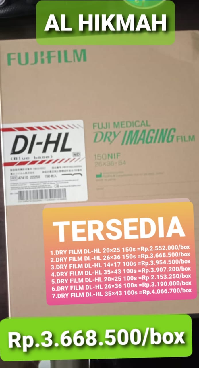 Dry Film DL-HL 26x36 150s